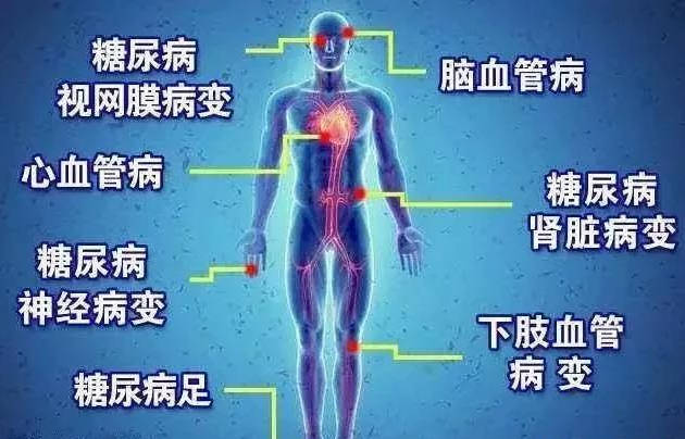 控制|糖尿病人不得并发症，要先养成7个好习惯