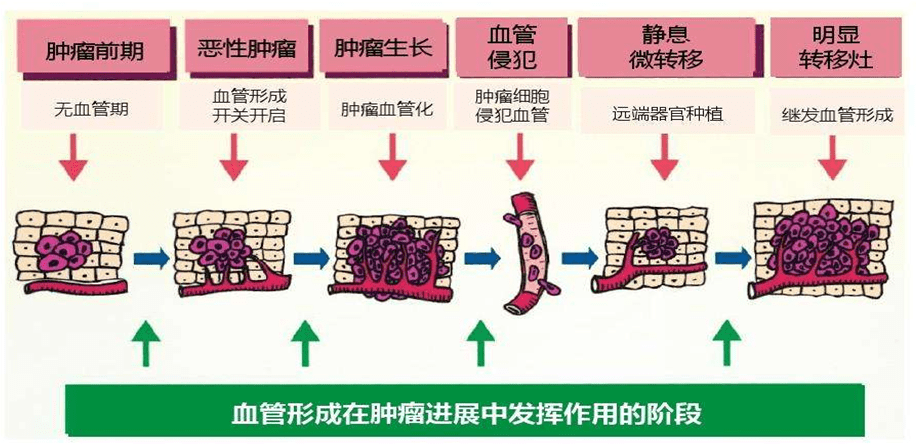 抗肿瘤血管生成是什么原理,看完你就豁然开昂都明白了_治疗