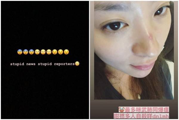 28岁港星岑宁童被传“试图轻生” 送医一天后发