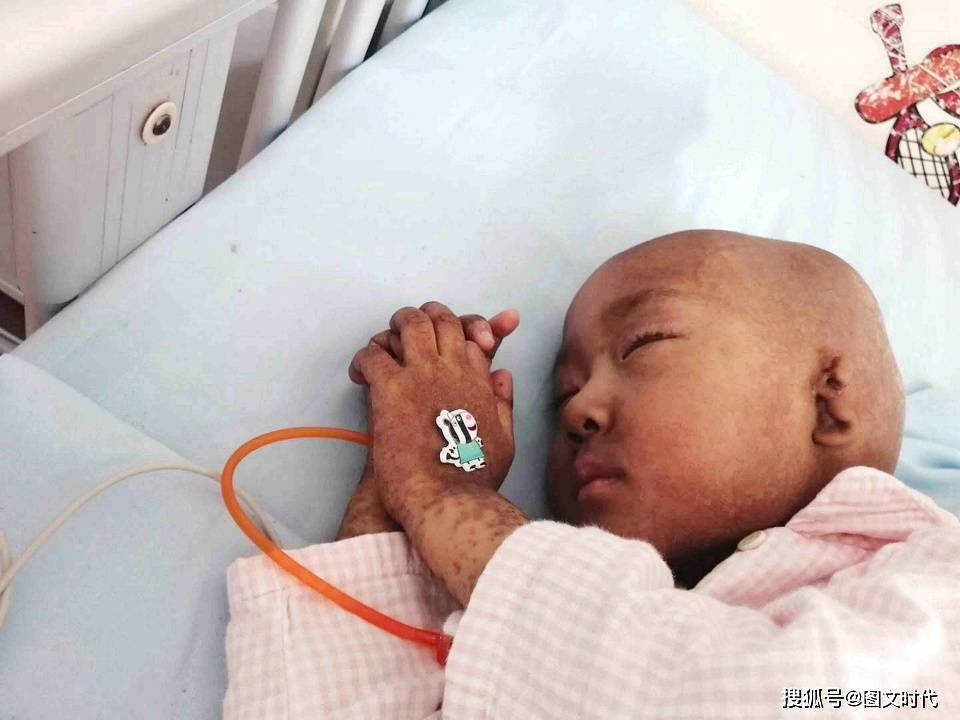 萱萱|4岁时随着一次喉咙的不舒服，噩梦降临了女童带着先天残缺出生