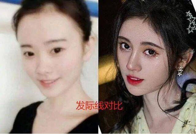 沥青|鞠婧祎新戏狂抹发际线粉，被嘲像涂了沥青，P掉以后秃头明显