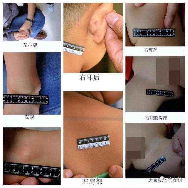 触目惊心!天津“针扎虐童案”一审宣判:3幼教不认罪,法院采信幼儿证言 触目惊心!天津“针扎虐童案”一审宣判:3幼教不认罪,法院采信幼儿证言