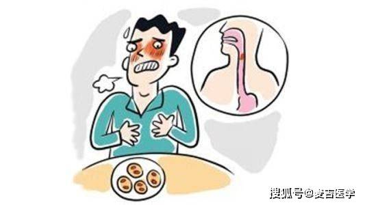 barrett食管是什么疾病?知道这4点,你就了解它了