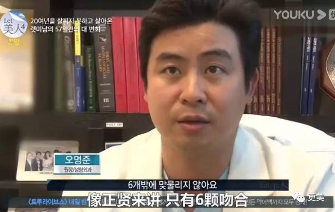 手术|回访|花3000万从“野兽”整成芭比的女孩，8年后过得怎么样