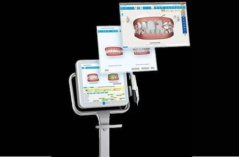 赛思数字化口扫设备 让牙齿隐形矫正更精准舒适