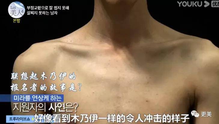 手术|回访|花3000万从“野兽”整成芭比的女孩，8年后过得怎么样