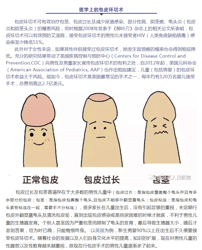 医学上的包皮环切术