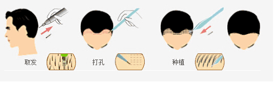 头发|娜扎消失的头发全回来了…这方法比鞠婧祎还高明！