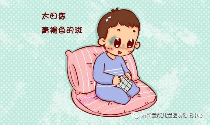 宝宝|专家带你快速了解宝宝胎记济南童康儿童医院