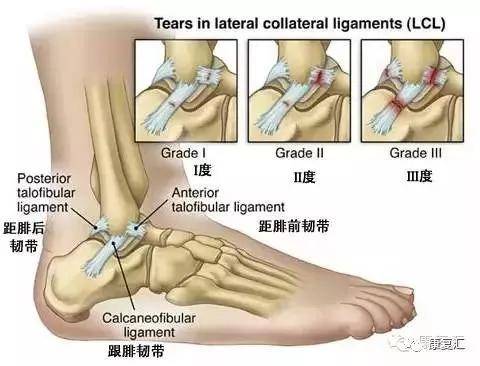 跌倒后肿了怎么办