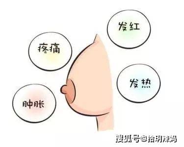 堵奶有硬块冷敷是什么原理_小腿有硬块是什么症状(2)