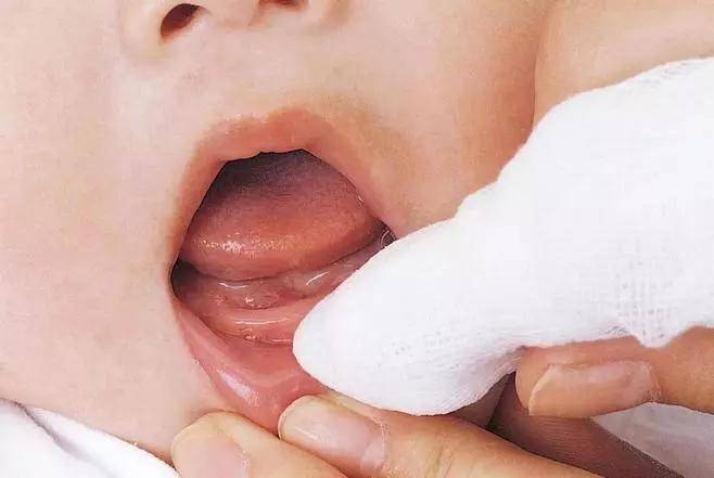 乳糖|从不吃糖的宝宝依然满口烂牙？小心奶粉里的“坏糖”在作祟