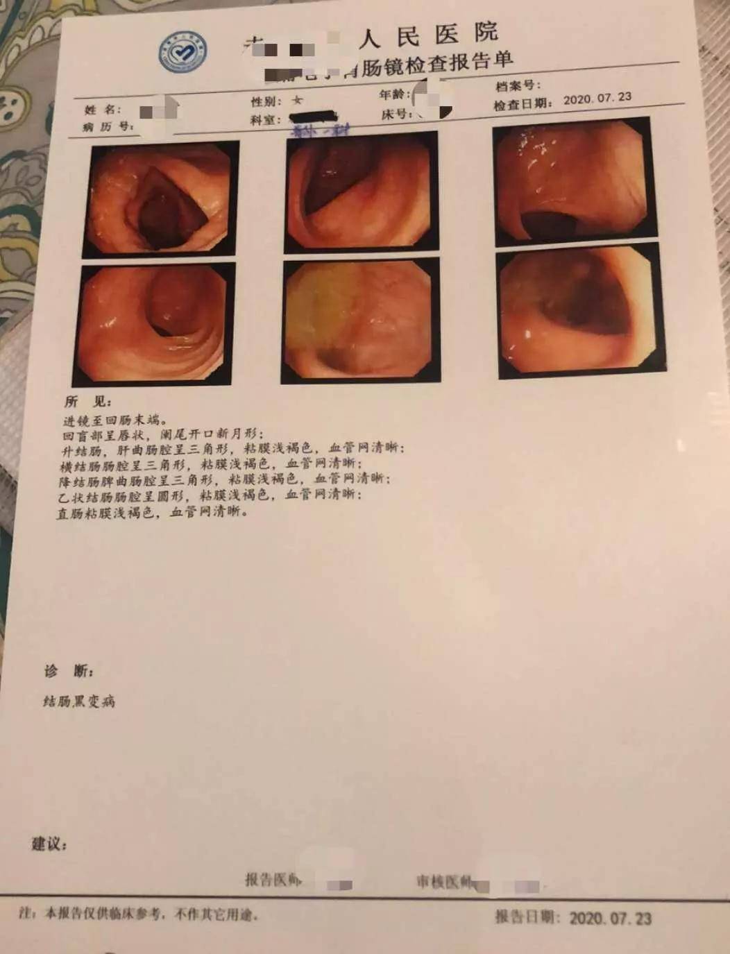 极大可能存在疾病风险,建议熊女士尽快到医院内科门诊接受肠镜检查