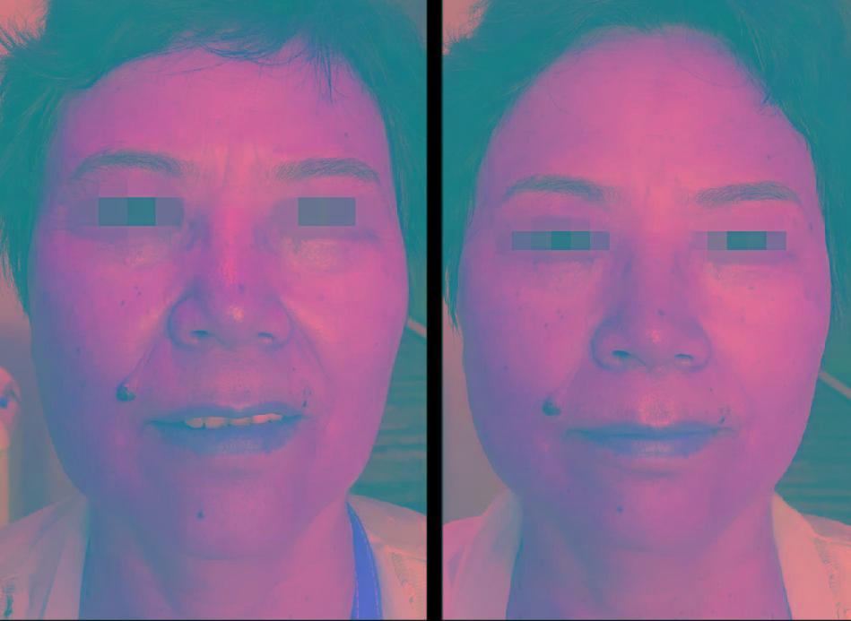 镜子|以前拿央视镜头当镜子，现在十级滤镜都磨不平，刘亦菲鼻子到底咋了？