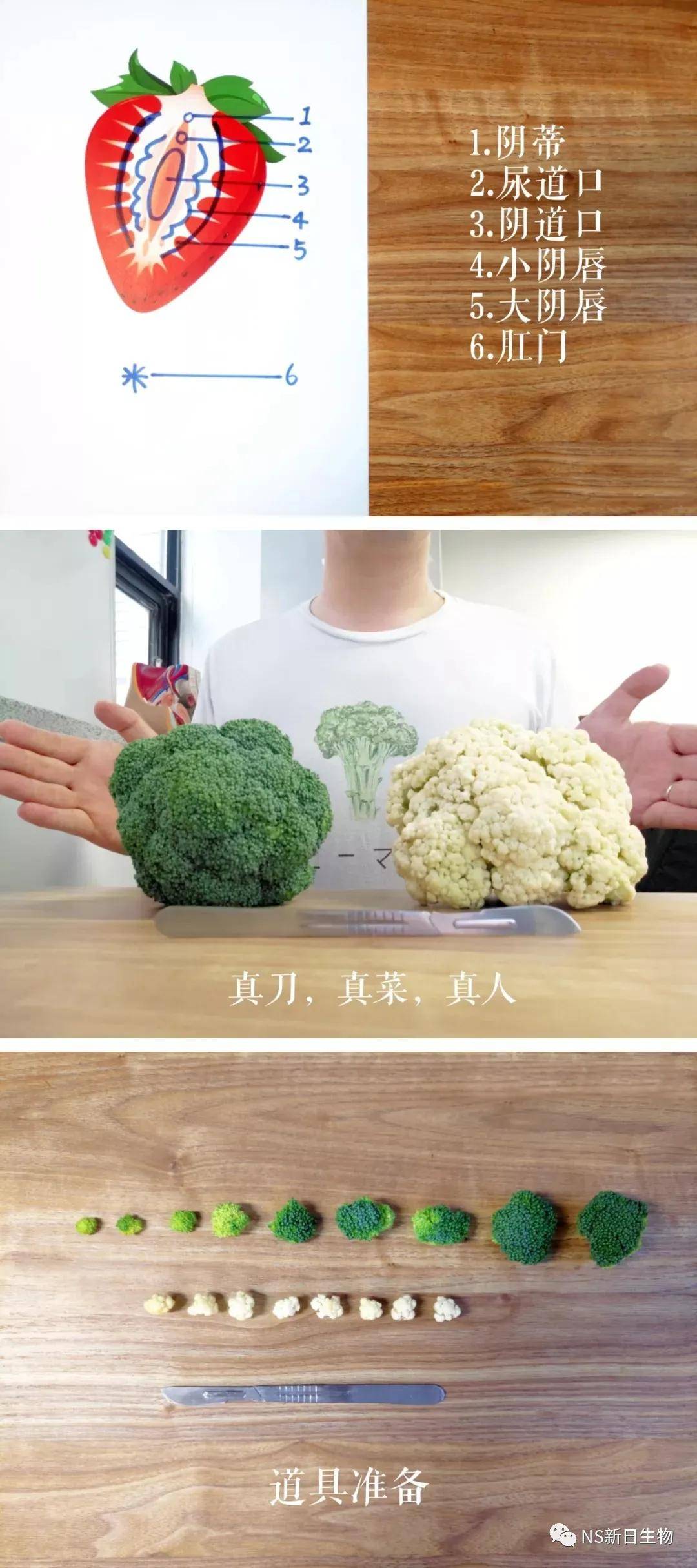 下面长了"小肉疙瘩",如何分辨真假尖锐湿疣?