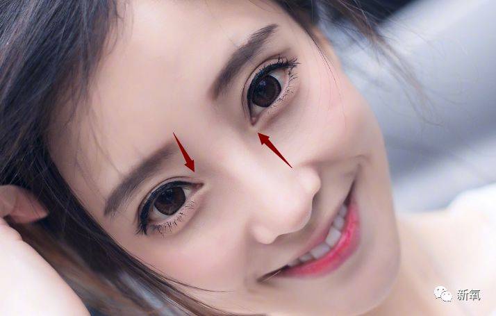 do|冯提莫这是后遗症出来了还是do了两次？搞成猪鼻子了…