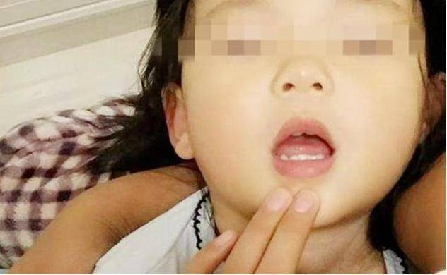 处理方式|奶奶淡定的处理方式,获医生点赞:厉害5岁孙女被鱼刺卡喉