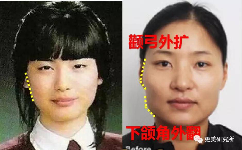 do|20年不崩的do圈C位,鞠婧祎baby都求她医生,堪称医学奇迹