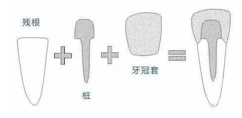 牙齿从根部断了怎么办