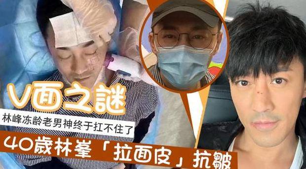陈浩民|陈浩民林峰都想做不老男神，结果一个打针一个拉皮，效果却相差太远