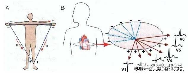 你做的心电图标准吗?来看看这些需要注意的细节