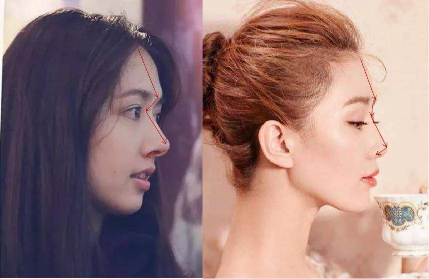 杨童舒|明明跟郭碧婷共用一张脸，她怎么就是恶毒女配的下场？