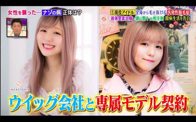 pippi|日本15岁患上“脱毛症”，却意外走上了新人生