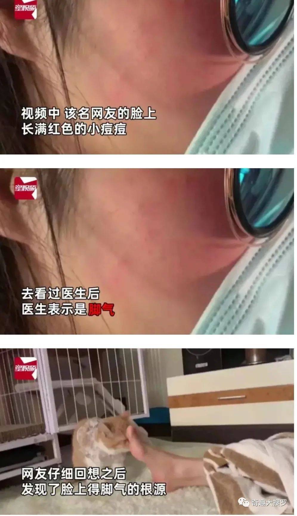 小女孩脸上竟然长了脚气用之前能不能先看看说明这都是什么骚操作