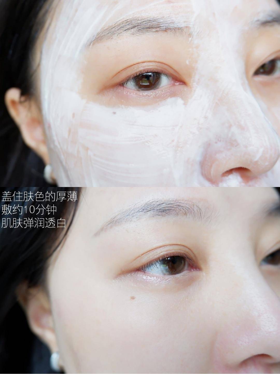 皮肤|口罩脸+换季!这下真的受不了了,敏感修复快看它