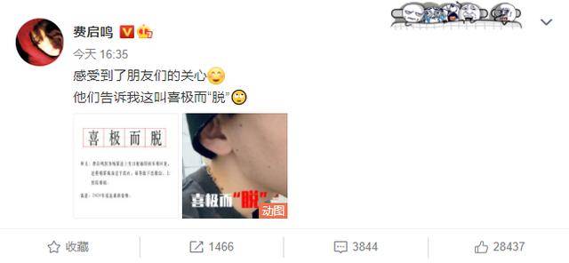 生日|原创费启鸣回应追星杨幂成功致下巴脱臼，学到新词“喜极而脱”