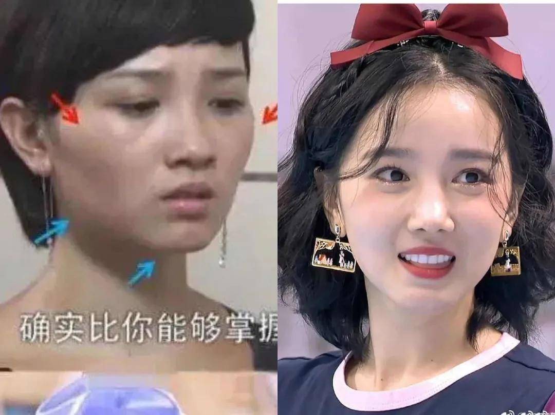 8分|3分到8分，为什么有人是天生适合整容脸?