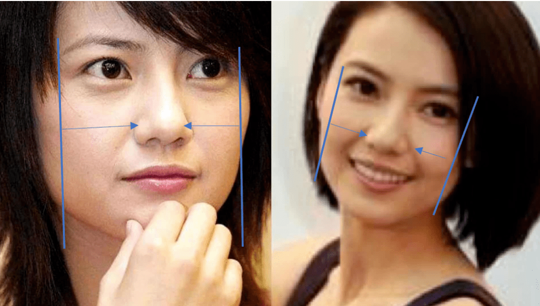 8分|3分到8分，为什么有人是天生适合整容脸?