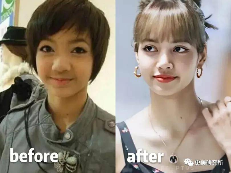 鼻尖|杨幂终于去修复鼻子了…