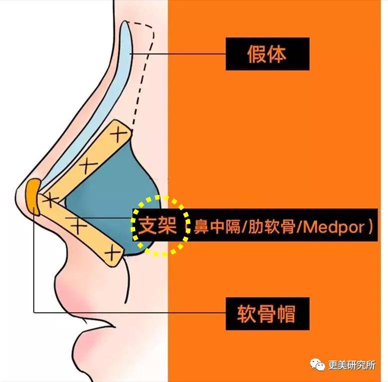 鼻尖|杨幂终于去修复鼻子了…