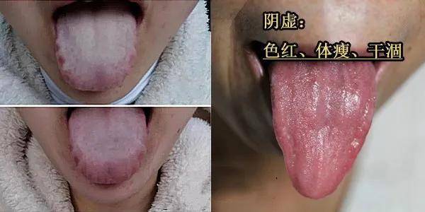 孩子|分清体质很重要!关键看这3点给孩子补充营养