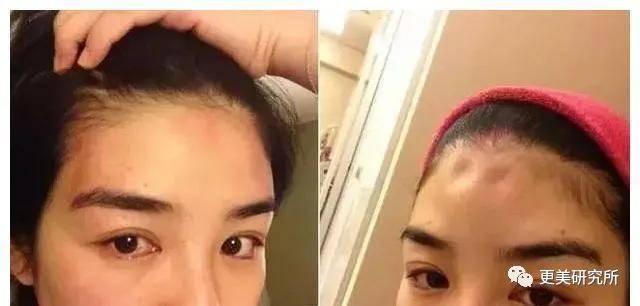 郭碧婷|比奚梦瑶、郭碧婷都惨的“豪门弃妇”，43岁颜值回春、好会do！