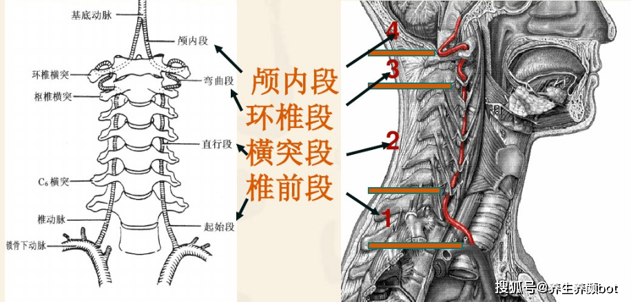 椎动脉型颈椎病