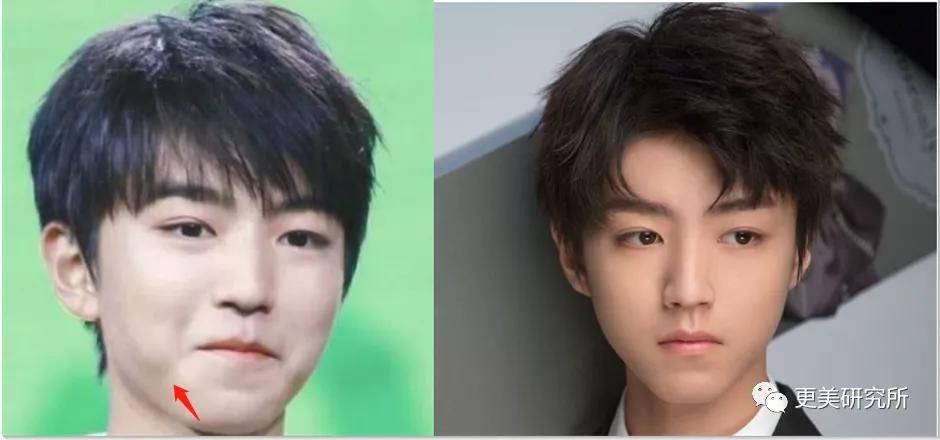 fa|今年最火的三字顶流这是要做鞠婧祎第二，换头动骨do全套？