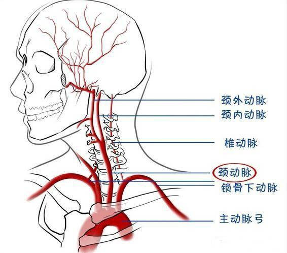 颈动脉斑块是怎么形成的?有什么危害?如何预防?_手机