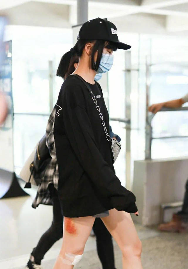 观众|原创因摔下舞台而受伤，哭着向观众道歉，她还坚持唱完了歌