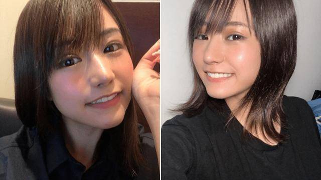 欺凌|长得丑被欺凌，日本妹子花400万成功“换头”，实现人生逆袭！