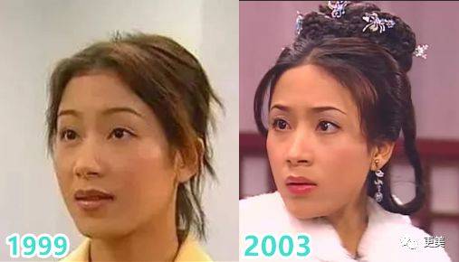 杨怡|曾经tvb一姐，演技一流，也把自己整僵了，假体太明显了...