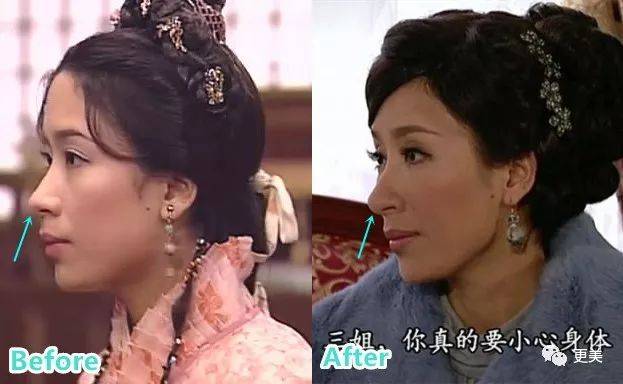 杨怡|曾经tvb一姐，演技一流，也把自己整僵了，假体太明显了...