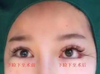 妖孽|Do4次鼻子开5次眼角花400w换头！这张妖孽脸看得我头皮发麻…