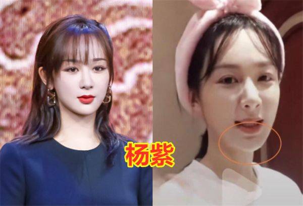 艺人卸妆后,杨紫黑眼圈,任嘉伦没变化,张予曦差距太大!_样子