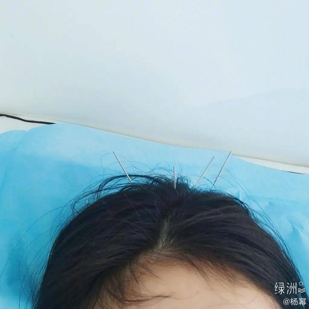 穿着|杨幂漫画腿过保了？她不惜往天灵盖上扎针也要救回来…