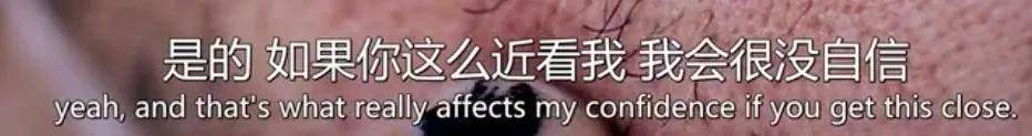 皮肤|16岁就上春晚的顶级流量，现在这脸怎么长残成这样了...