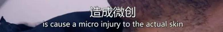 皮肤|16岁就上春晚的顶级流量，现在这脸怎么长残成这样了...