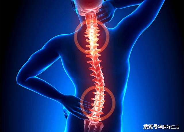 强直性脊椎炎是一种比较常见的脊柱病症,强直性脊椎炎通常会表现出