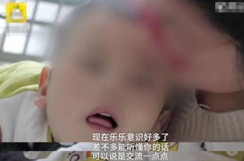 孩子|还不准母亲送他去医院，孩子至今不会说话男婴被亲爸打成脑积水